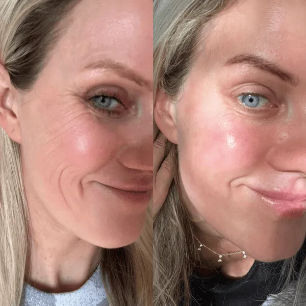 Advanced Hyaluronic Acid Serum (Hydrating) - Dry, Dull, Wrinkles